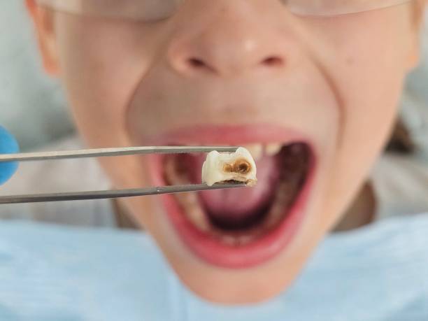 Best Tooth Pain Emergency Relief  in Barnesville, OH
